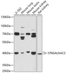 Western blot - ST6GALNAC2 antibody (A17618)