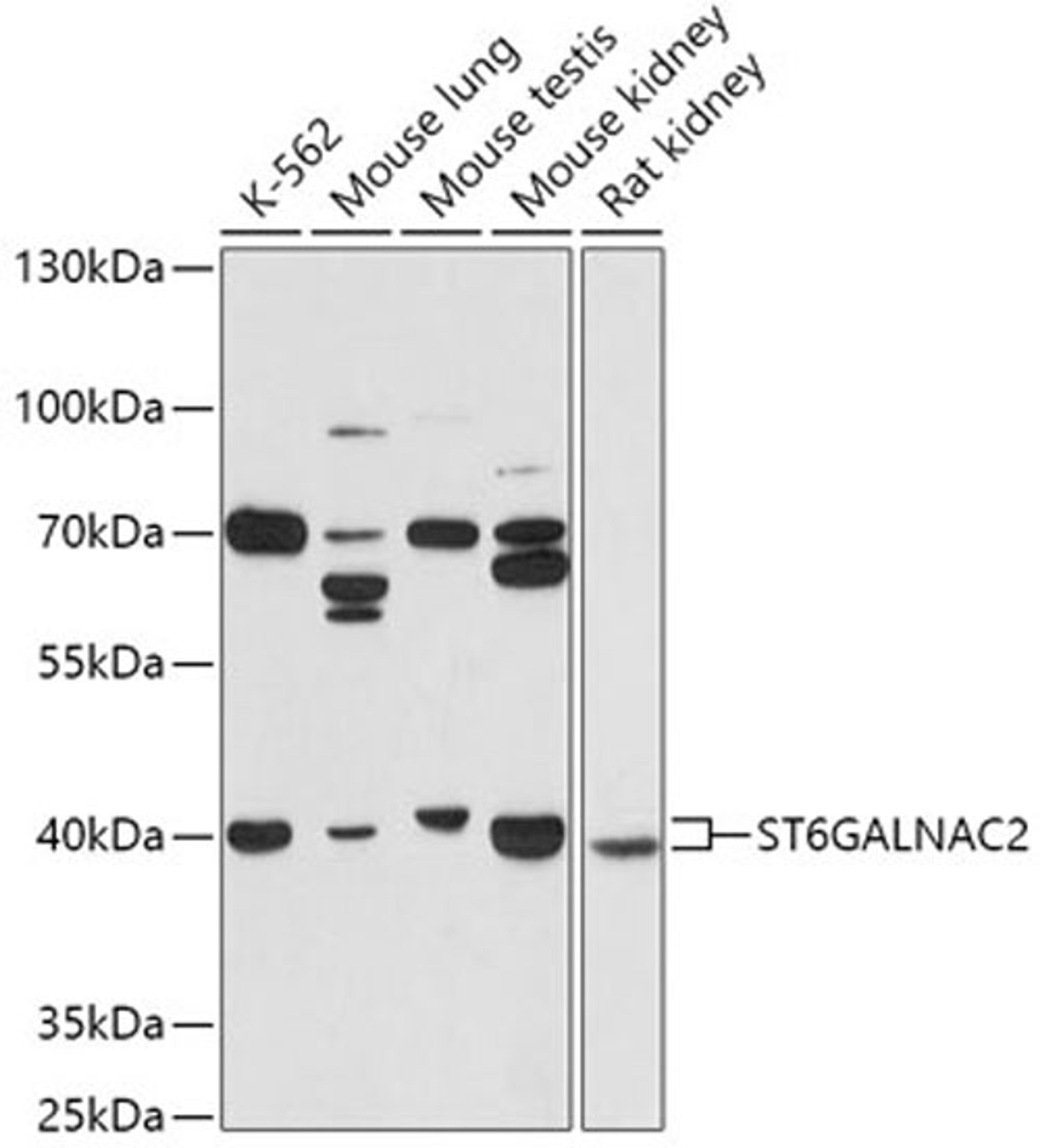 Western blot - ST6GALNAC2 antibody (A17618)