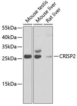 Western blot - CRISP2 antibody (A7177)