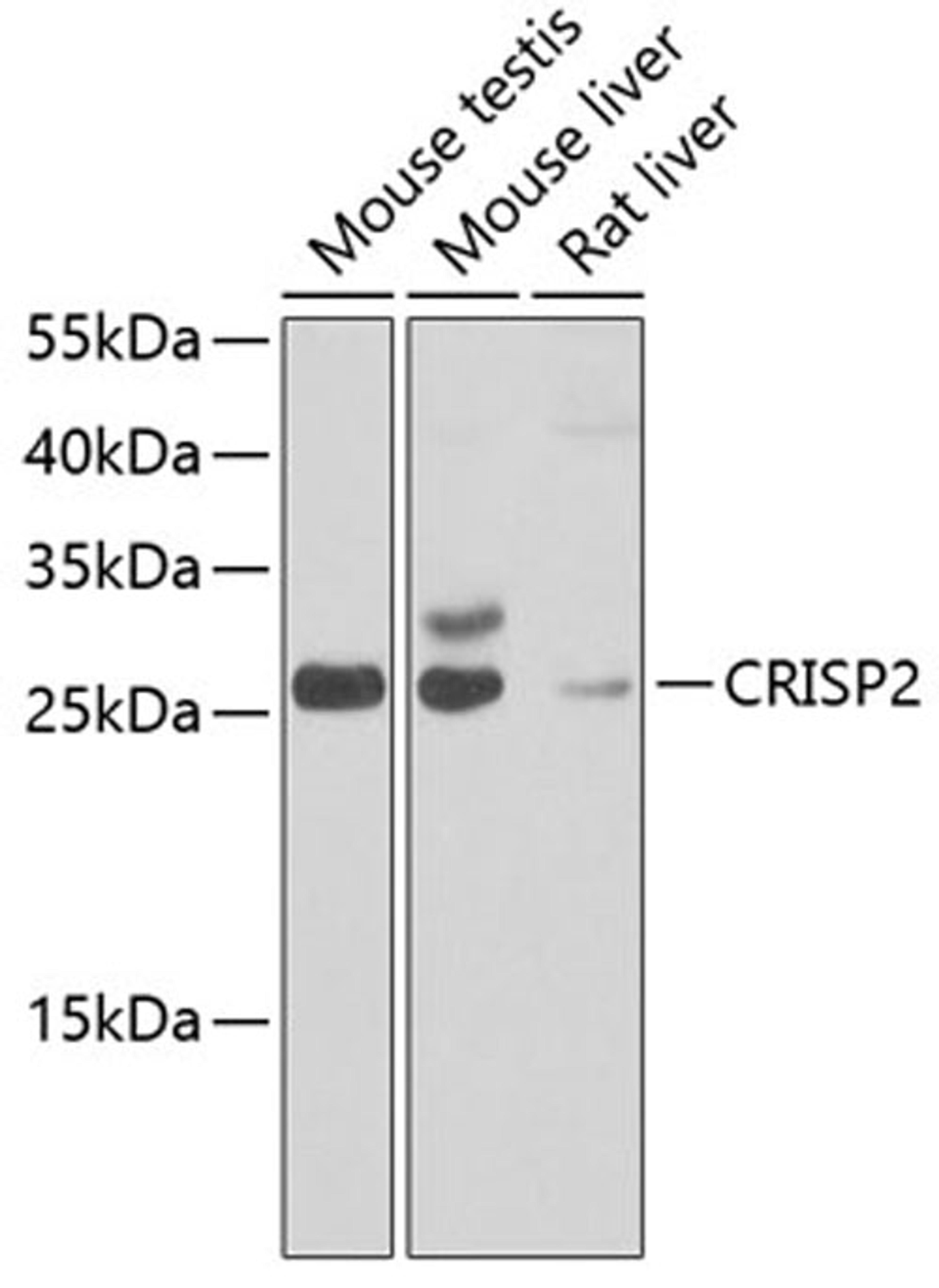 Western blot - CRISP2 antibody (A7177)