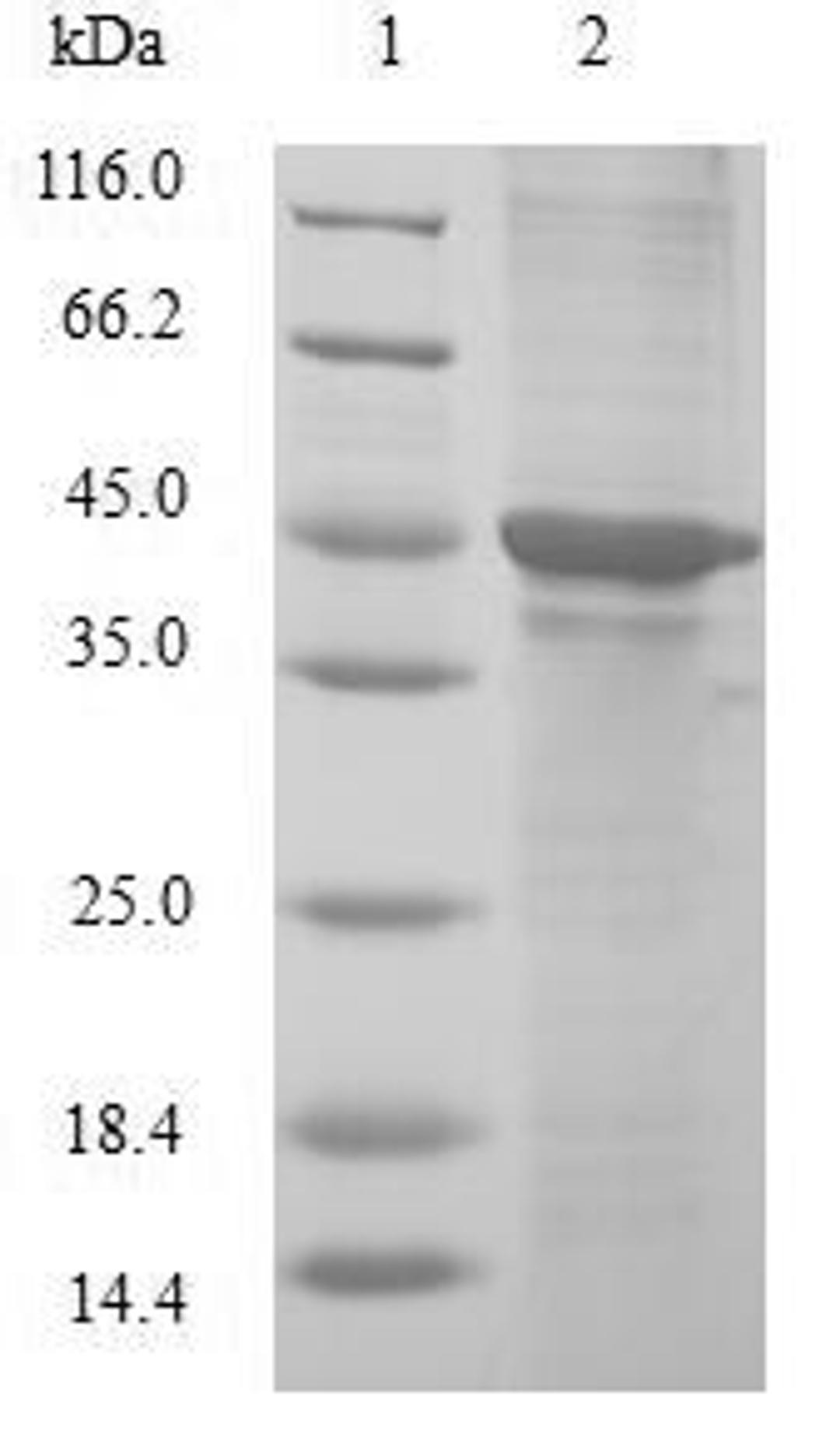 (Tris-Glycine gel) Discontinuous SDS-PAGE (reduced) with 5% enrichment gel and 15% separation gel.