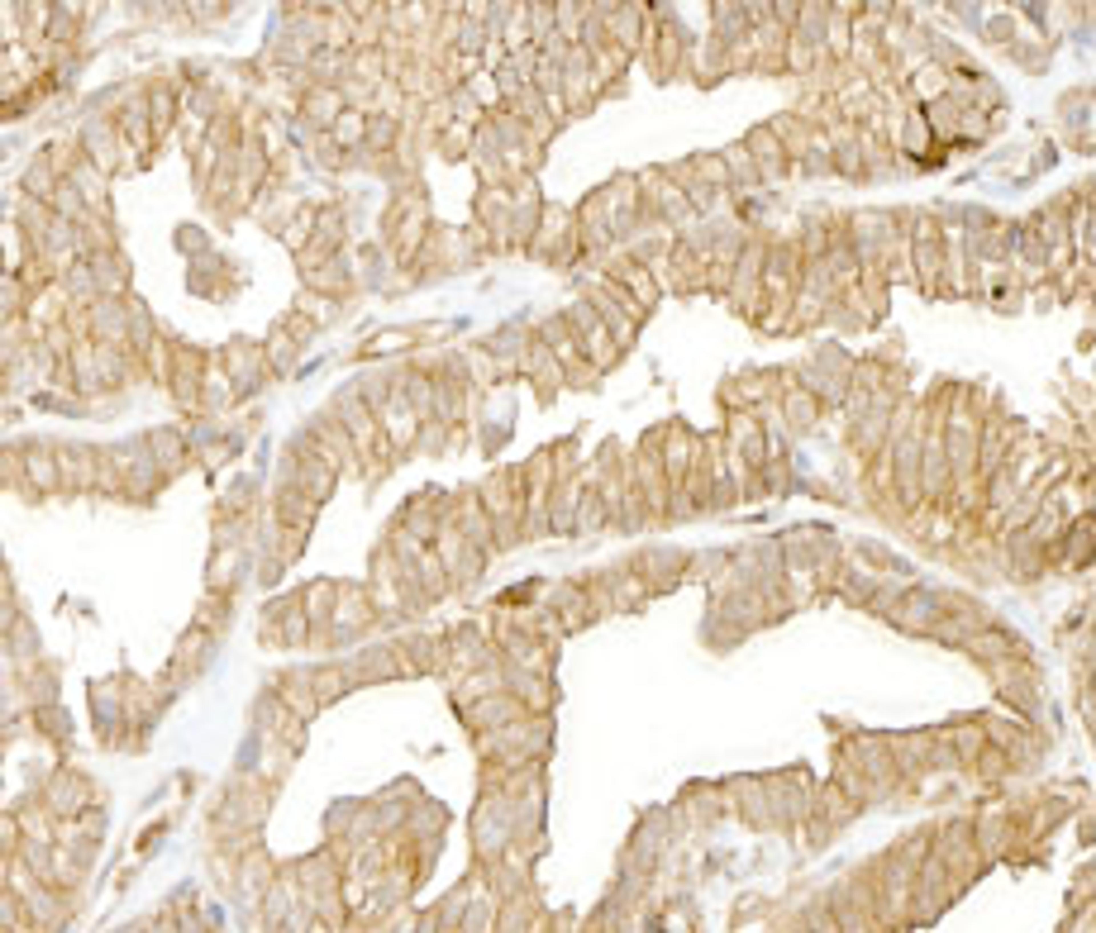 Detection of human Cytoskeletal Actin by immunohistochemistry. 