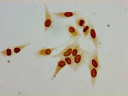 Immunocytochemistry analysis of Hela cells using CSB-PA010378PA62acHU at dilution of 1:100