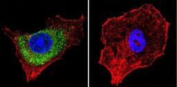 Immunocytochemistry/Immunofluorescence: Mannose 6 Phosphate Receptor (Cation independent) Antibody (2G11) [NB300-514] - Mannose 6-Phosphate Receptor staining (green), F-Actin staining with Phalloidin (red) and nuclei with DAPI (blue) is shown. Cells were grown on chamber slides and fixed with formaldehyde prior to staining. Cells were probed without (control) or with or an antibody recognizing Mannose 6-Phosphate Receptor at a dilution of 1:20 over night at 4C, washed with PBS and incubated with a DyLight-488 conjugated.