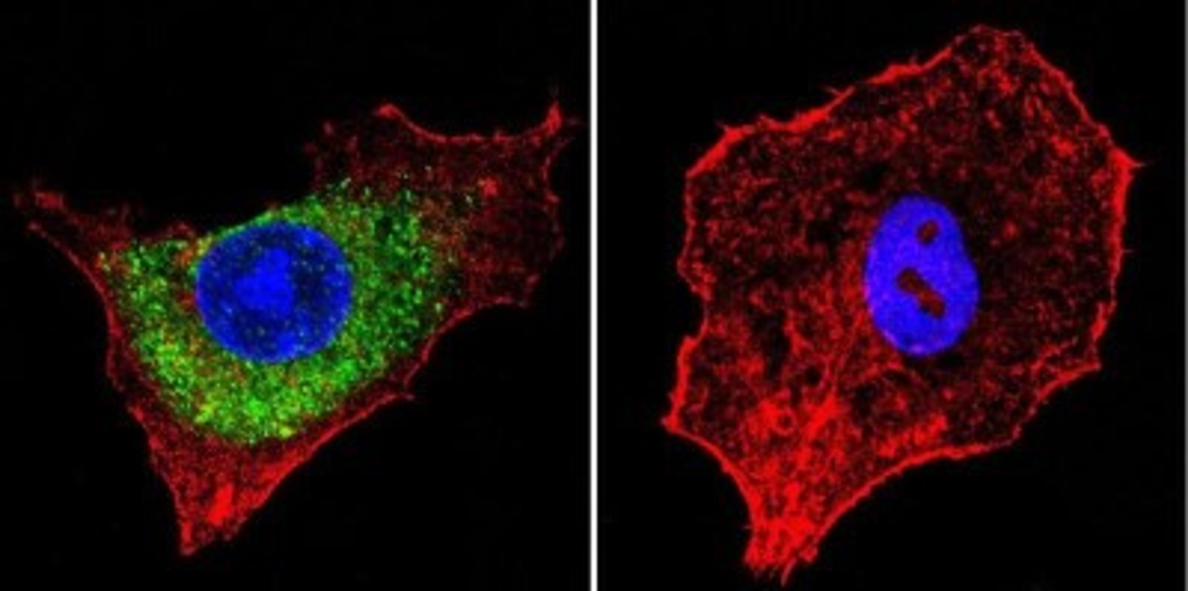 Immunocytochemistry/Immunofluorescence: Mannose 6 Phosphate Receptor (Cation independent) Antibody (2G11) [NB300-514] - Mannose 6-Phosphate Receptor staining (green), F-Actin staining with Phalloidin (red) and nuclei with DAPI (blue) is shown. Cells were grown on chamber slides and fixed with formaldehyde prior to staining. Cells were probed without (control) or with or an antibody recognizing Mannose 6-Phosphate Receptor at a dilution of 1:20 over night at 4C, washed with PBS and incubated with a DyLight-488 conjugated.