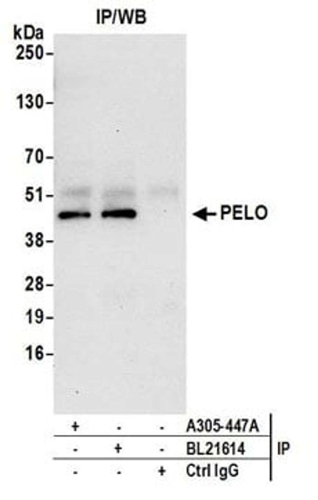 Detection of human PELO by western blot of immunoprecipitates.