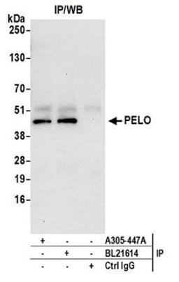 Detection of human PELO by western blot of immunoprecipitates.