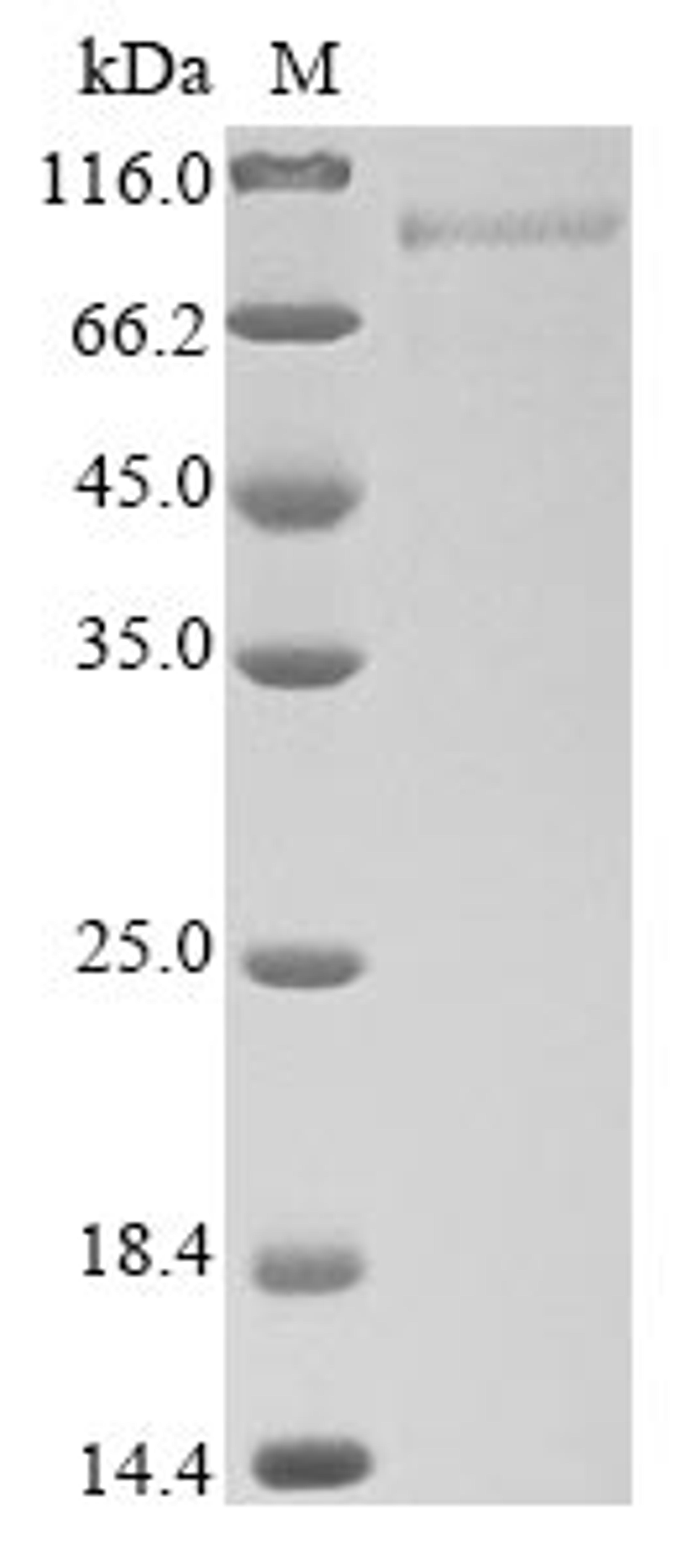 (Tris-Glycine gel) Discontinuous SDS-PAGE (reduced) with 5% enrichment gel and 15% separation gel.