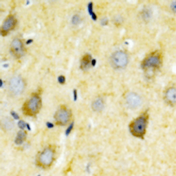 Immunohistochemical staining of human brain using GRIN2B (Phospho-Y1336) antibody