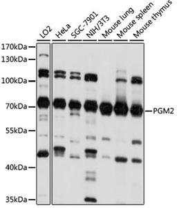 Western blot - PGM2 antibody (A15467)