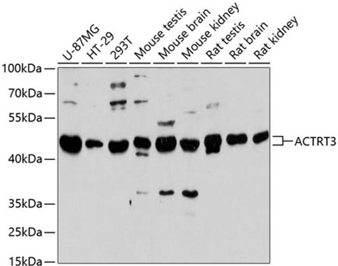 Western blot - ACTRT3 antibody (A13198)