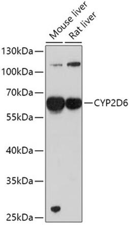 Western blot - CYP2D6 antibody (A1299)