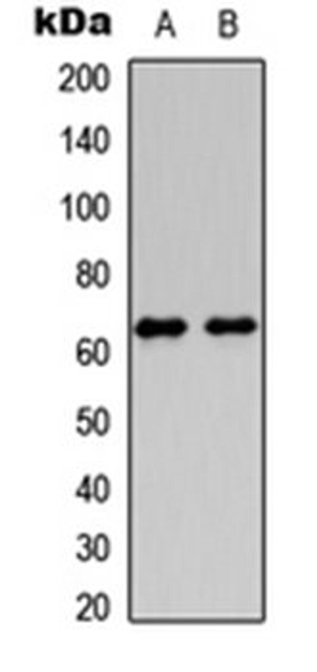 Western blot analysis of HeLa (Lane 1), PC12 (Lane 2) whole cell lysates using HABP2 HC antibody