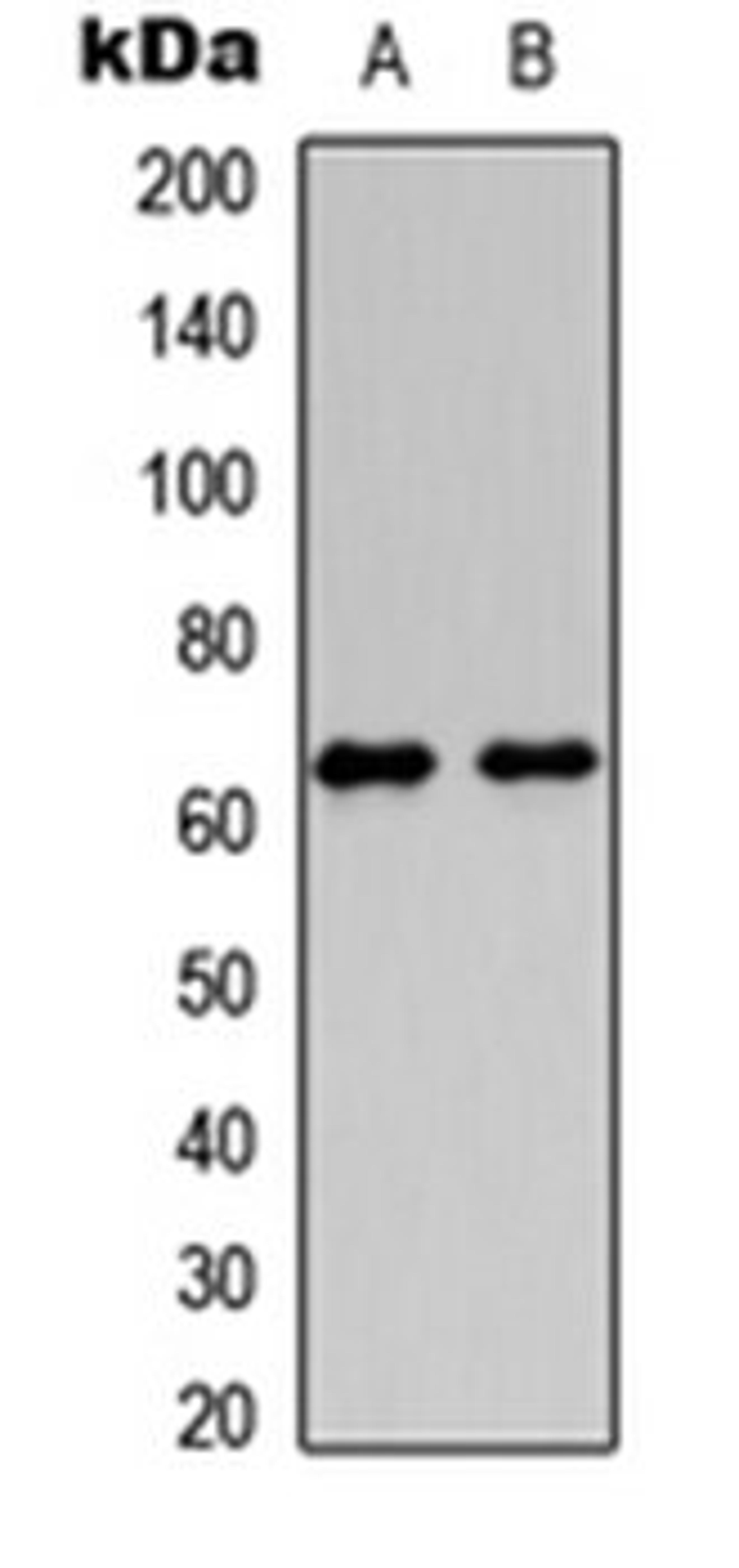 Western blot analysis of HeLa (Lane 1), PC12 (Lane 2) whole cell lysates using HABP2 HC antibody