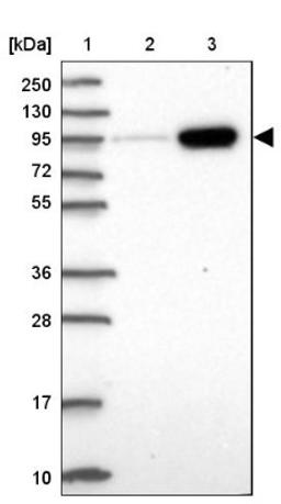 Western Blot: AMPD2 Antibody [NBP2-47549] - Lane 1: Marker [kDa] 250, 130, 95, 72, 55, 36, 28, 17, 10.  Lane 2: Human cell line RT-4.  Lane 3: Human cell line U-251MG.