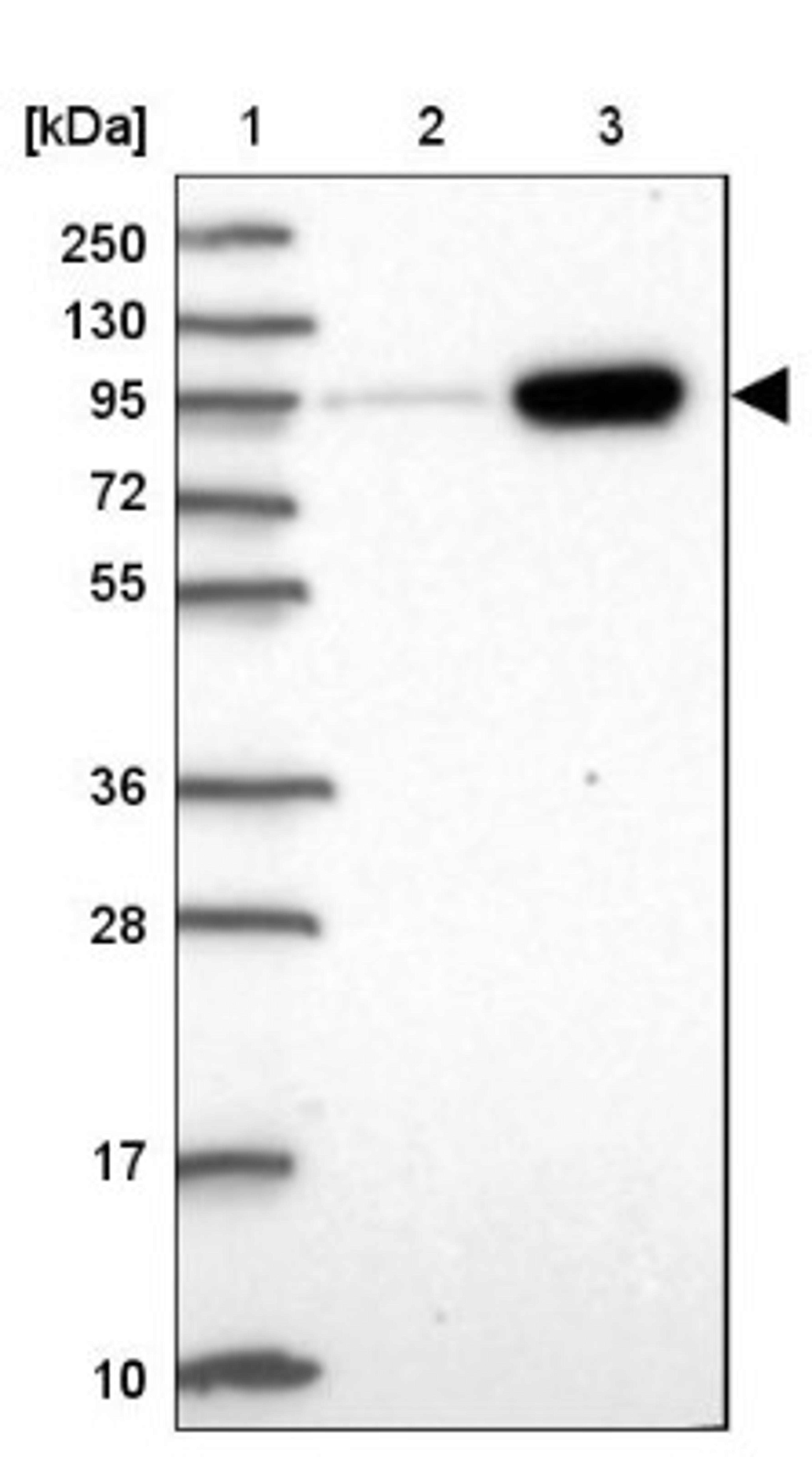 Western Blot: AMPD2 Antibody [NBP2-47549] - Lane 1: Marker [kDa] 250, 130, 95, 72, 55, 36, 28, 17, 10.  Lane 2: Human cell line RT-4.  Lane 3: Human cell line U-251MG.