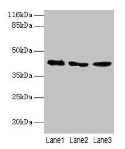 Western blot. All lanes: ATXN3 antibody at 2µg/ml. Lane 1: 293T whole cell lysate. Lane 2: Mouse brain tissue. Lane 3: MCF-7 whole cell lysate. Secondary. Goat polyclonal to rabbit IgG at 1/10000 dilution. Predicted band size: 42, 36, 40, 21 kDa. Observed band size: 42 kDa