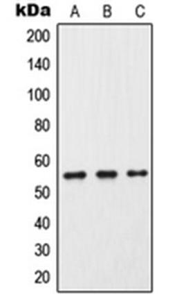 Western blot analysis of HeLa (Lane 1), Raw264.7 (Lane 2), PC12 (Lane 3) whole cell lysates using CP2C9 antibody