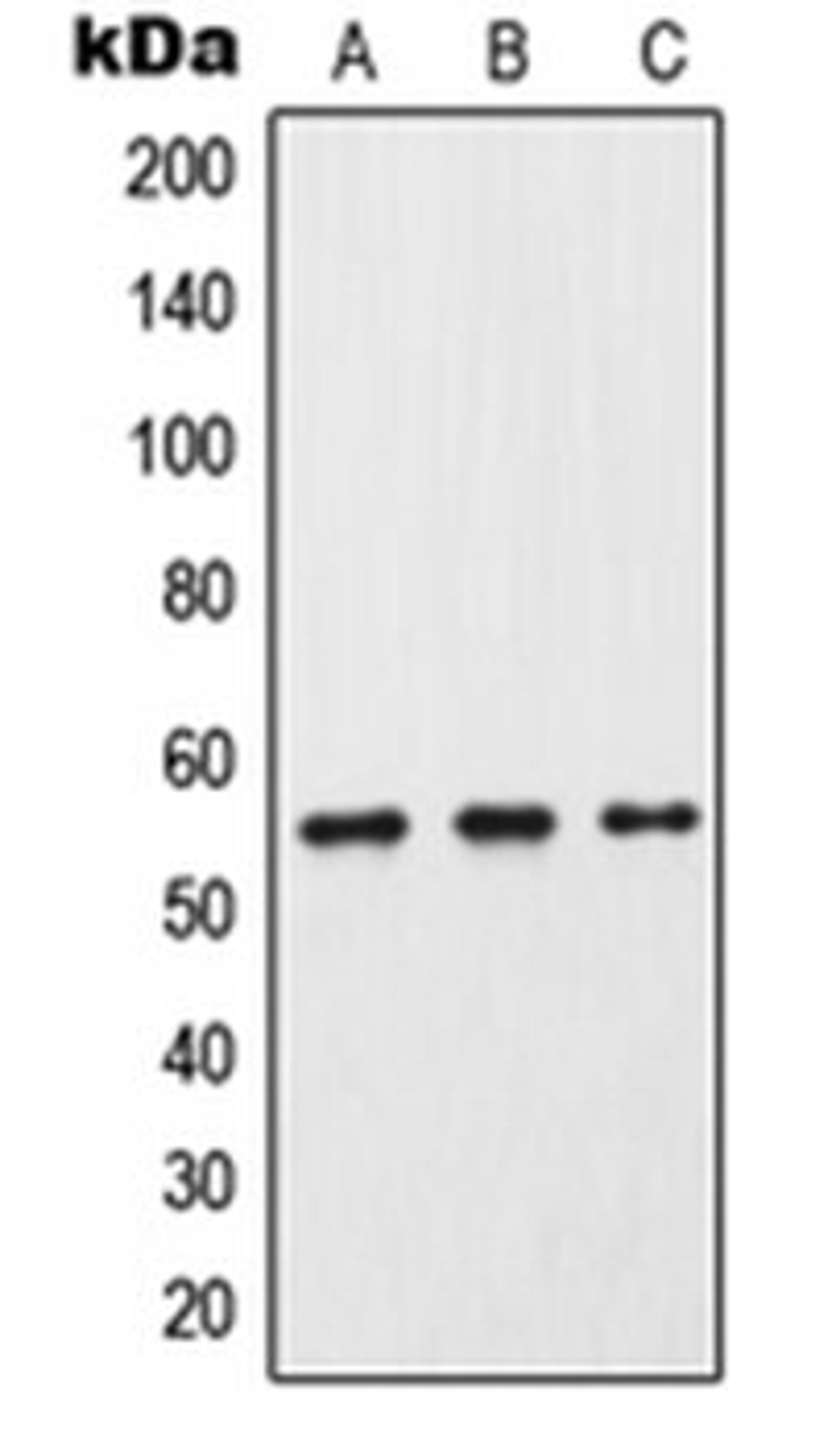 Western blot analysis of HeLa (Lane 1), Raw264.7 (Lane 2), PC12 (Lane 3) whole cell lysates using CP2C9 antibody