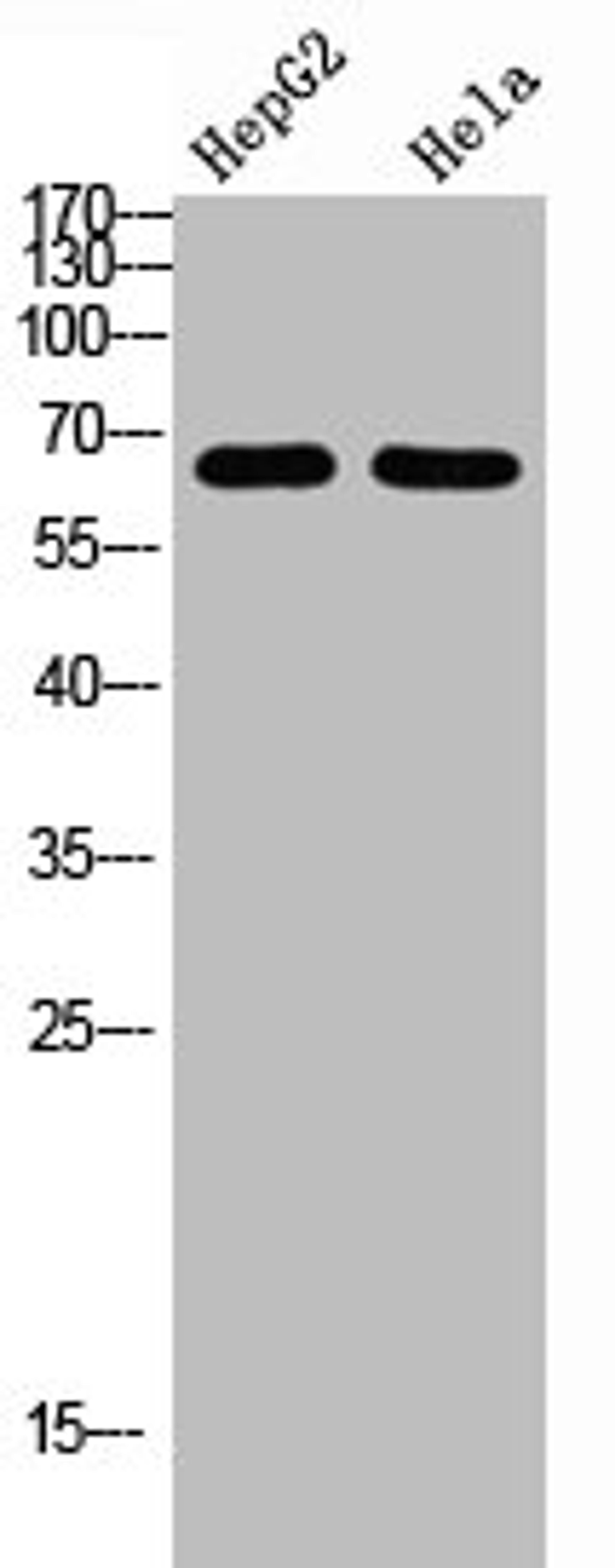 Western Blot analysis of HEPG2 Hela cells using NOP56 Polyclonal Antibody diluted at 1:1000. Secondary antibody was diluted at 1:20000
