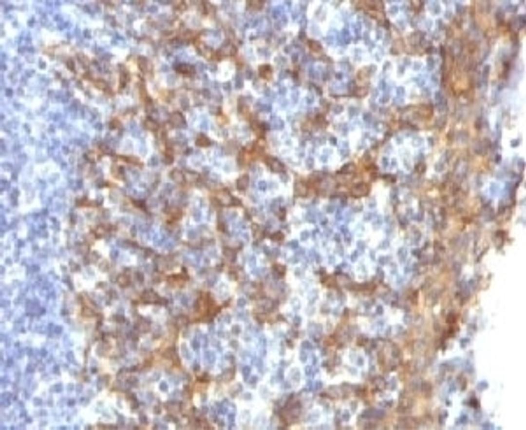 IHC testing of FFPE human prostate with Keratin 14 antibody.