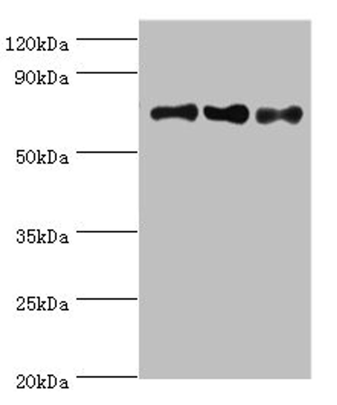 Western blot. All lanes: NCL antibody at 8ug/ml. Lane 1: Jurkat whole cell lysate. Lane 2: Hela whole cell lysate. Lane 3: 293T whole cell lysate. Secondary. Goat polyclonal to rabbit IgG at 1/10000 dilution. Predicted band size: 77 kDa. Observed band size: 77 kDa. 
