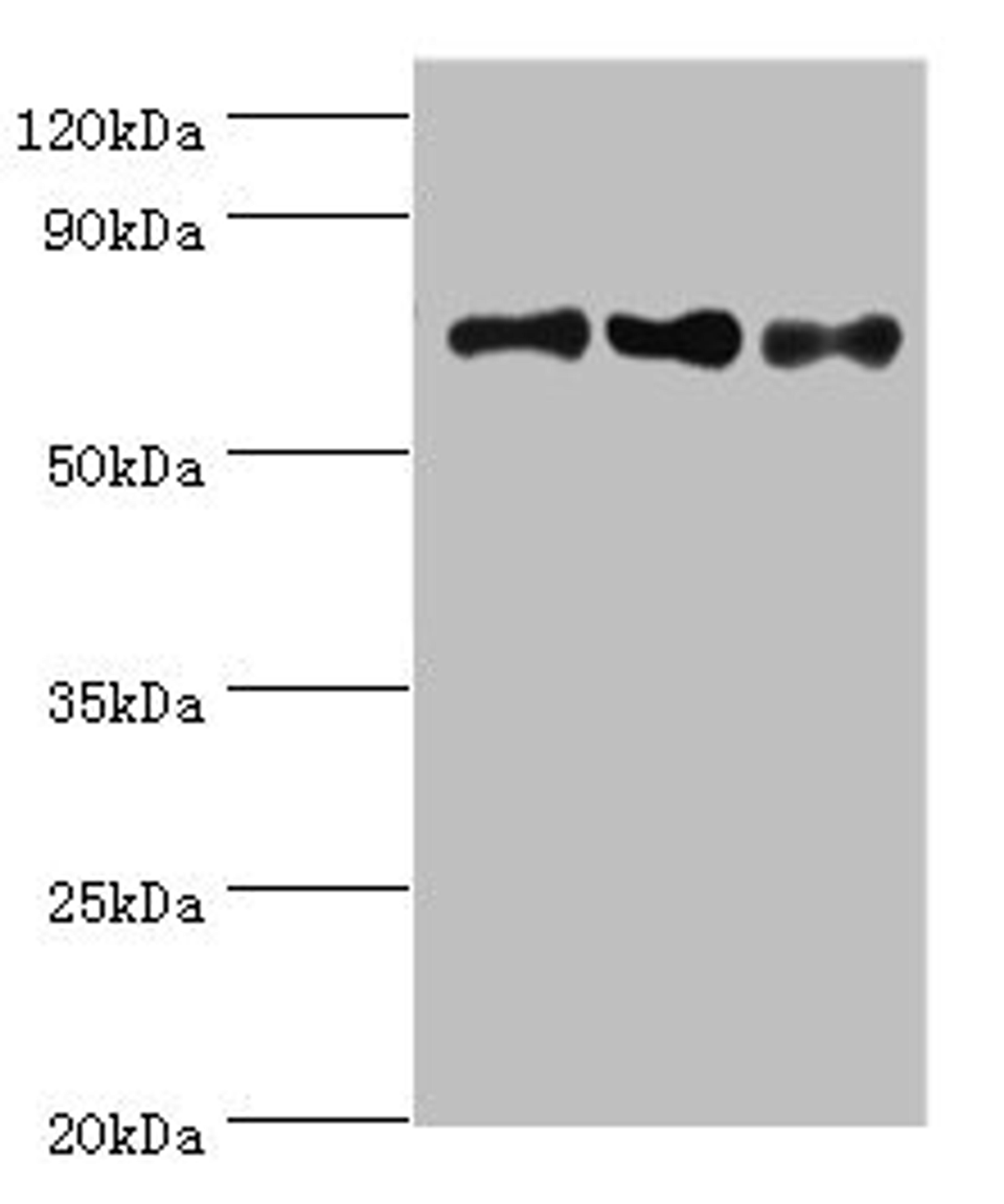 Western blot. All lanes: NCL antibody at 8ug/ml. Lane 1: Jurkat whole cell lysate. Lane 2: Hela whole cell lysate. Lane 3: 293T whole cell lysate. Secondary. Goat polyclonal to rabbit IgG at 1/10000 dilution. Predicted band size: 77 kDa. Observed band size: 77 kDa. 