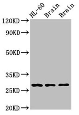 Western Blot. Positive WB detected in: Rat brain tissue, Mouse brain tissue. All lanes: EMX2 antibody at 2.7ug/ml. Secondary. Goat polyclonal to rabbit IgG at 1/50000 dilution. Predicted band size: 29, 19 kDa. Observed band size: 29 kDa.