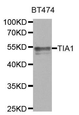 Western blot analysis of extracts of BT474 cell line using TIA1 antibody