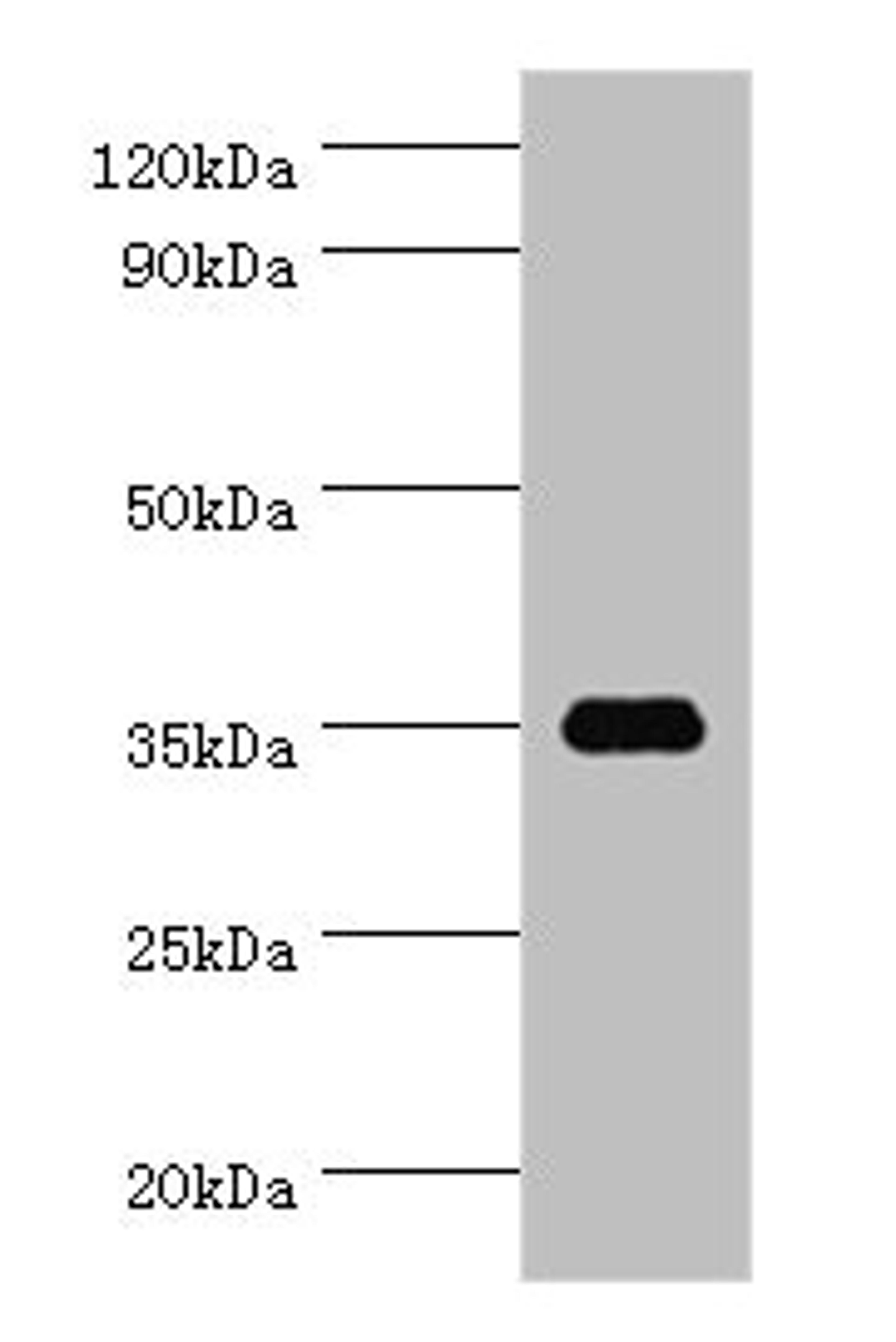 Western blot. All lanes: SULT1C2 antibody at 5ug/ml + Hela whole cell lysate. Secondary. Goat polyclonal to rabbit IgG at 1/10000 dilution. Predicted band size: 35, 36 kDa. Observed band size: 35 kDa. 