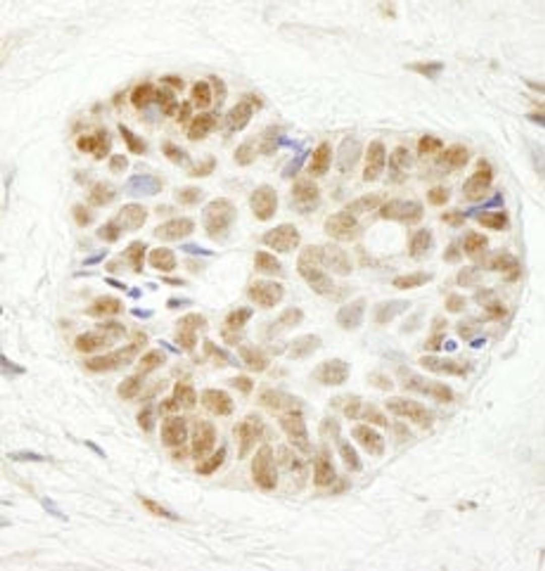 Detection of human WDR79 immunohistochemistry.