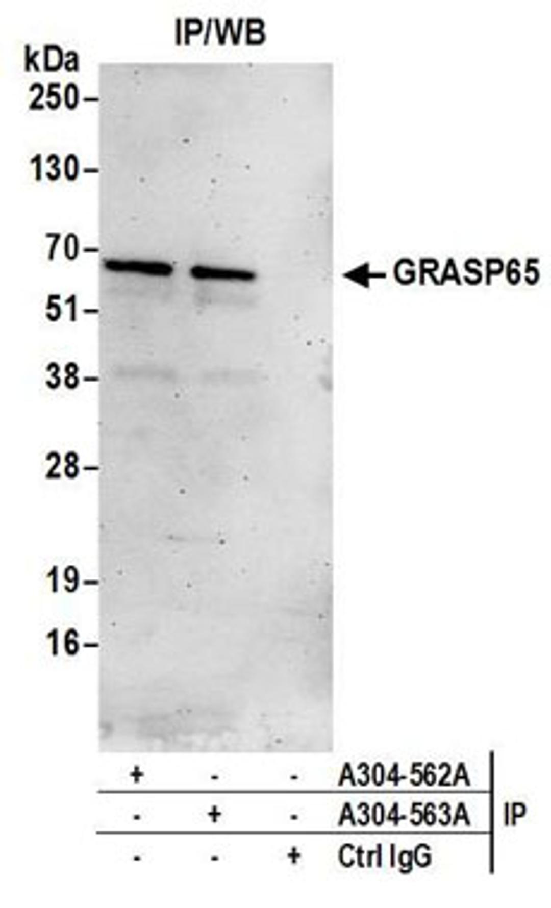 Detection of human GRASP65 by western blot of immunoprecipitates.