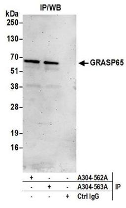 Detection of human GRASP65 by western blot of immunoprecipitates.