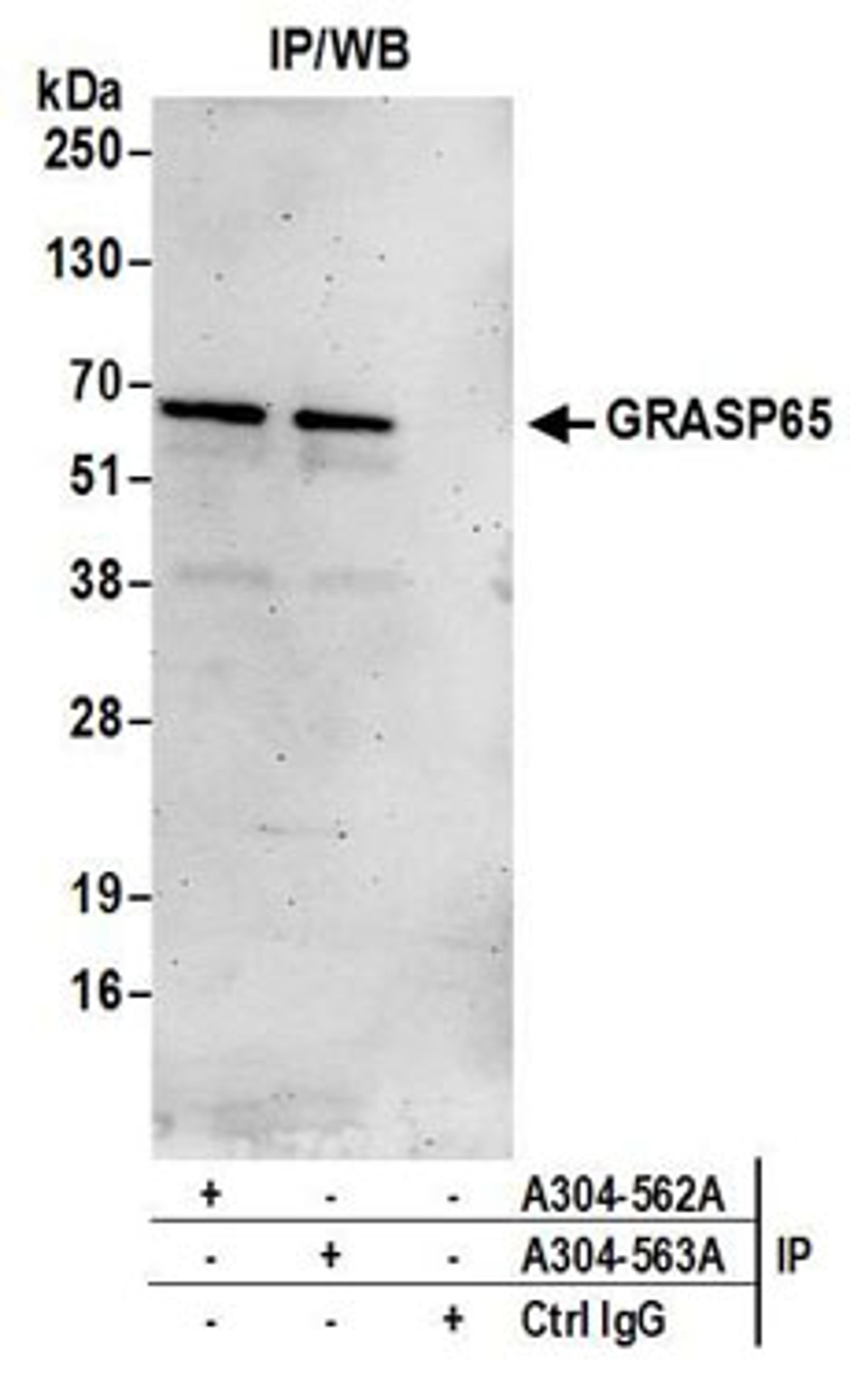 Detection of human GRASP65 by western blot of immunoprecipitates.