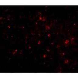 Immunocytochemistry/Immunofluorescence: Orai1 Antibody (3F6H5) [NBP1-75522] - ORAI1 in human spleen cells with ORAI1 antibody at 20 ug/ml.