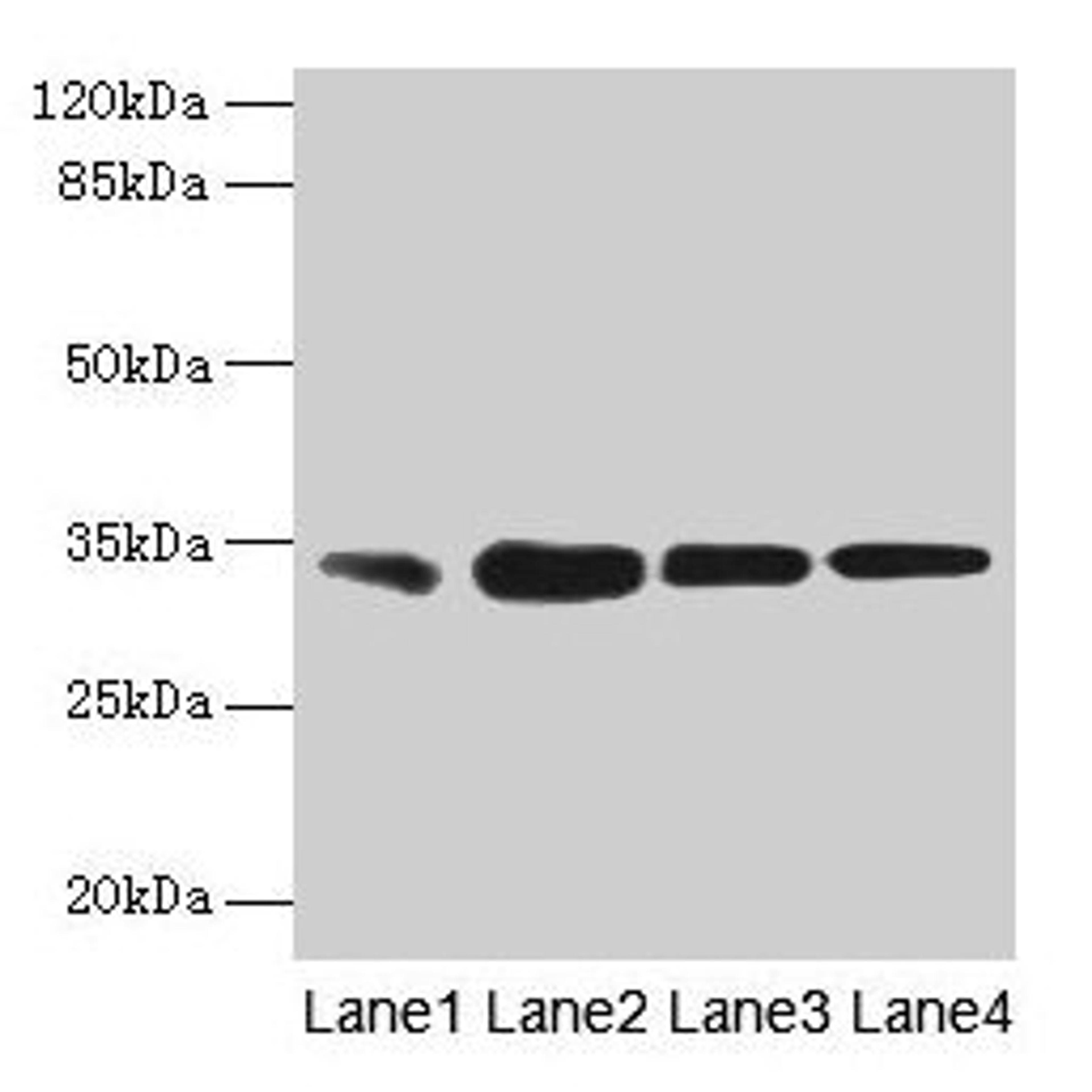 Western blot. All lanes: RAD23A antibody at 3µg/ml. Lane 1: MCF-7 whole cell lysate. Lane 2: Hela whole cell lysate. Lane 3: Raji whole cell lysate. Lane 4: Jurkat whole cell lysate. Secondary. Goat polyclonal to rabbit IgG at 1/10000 dilution. Predicted band size: 40, 34 kDa. Observed band size: 34 kDa