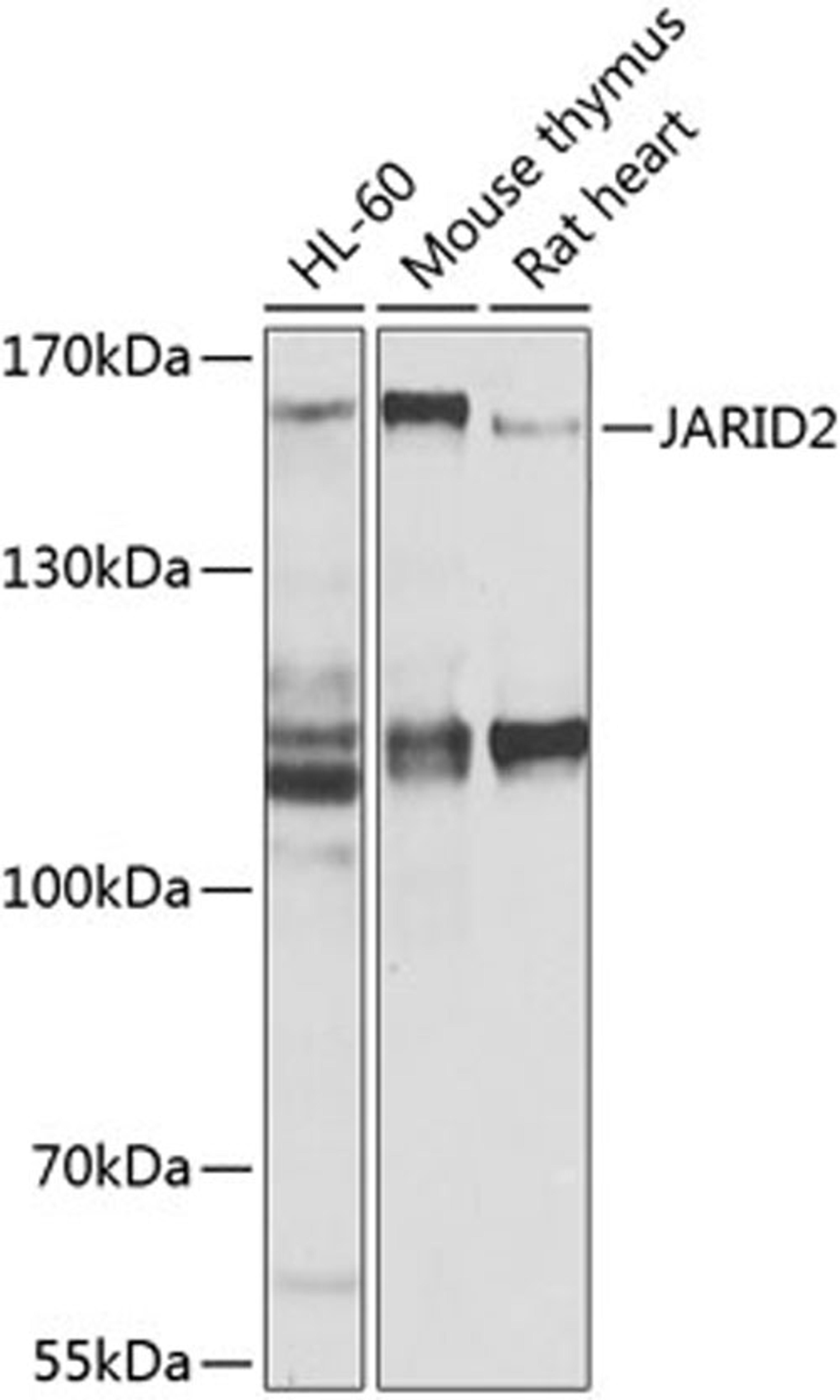 Western blot - JARID2 antibody (A9823)