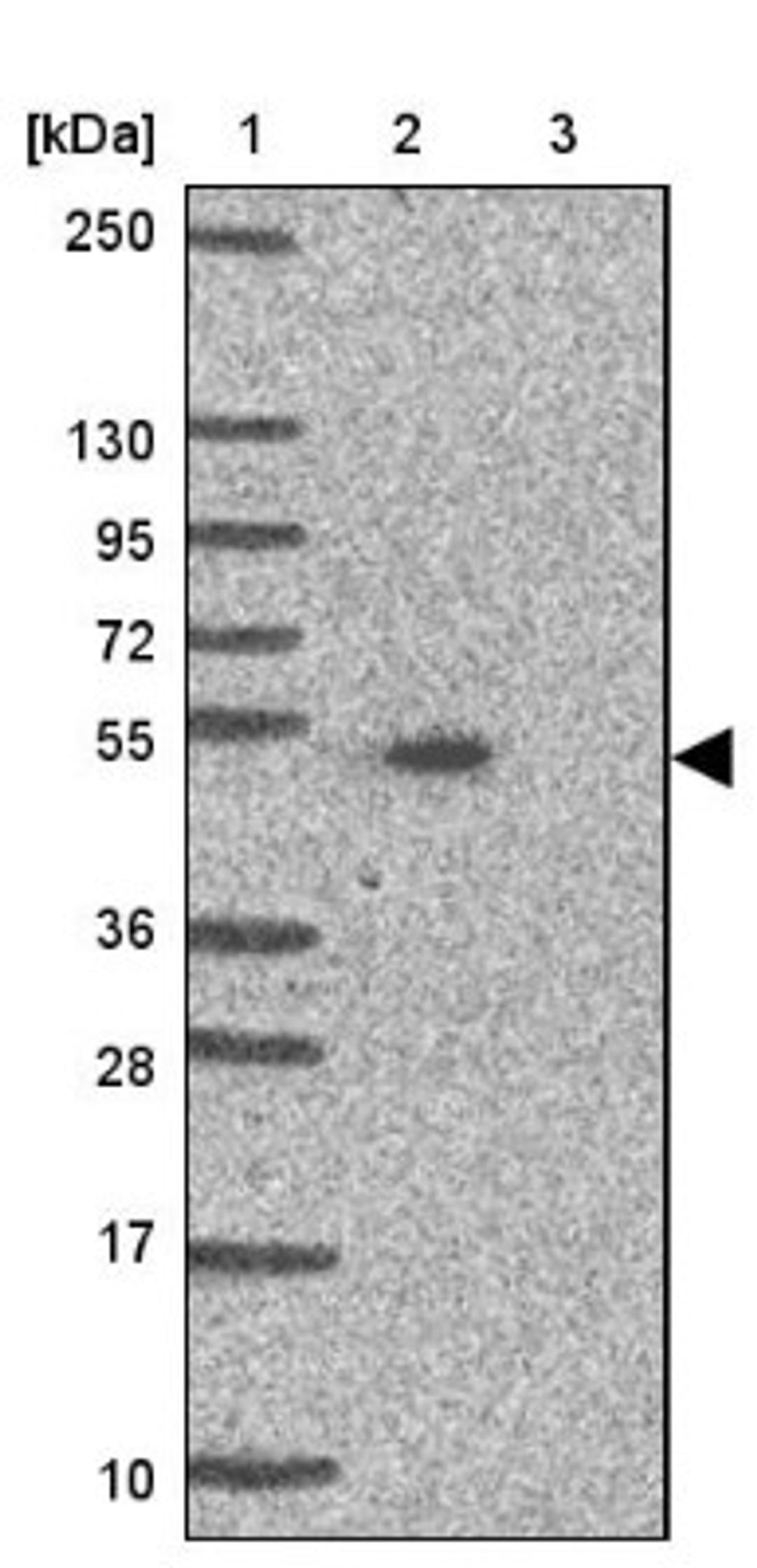 Western Blot: ALS2CR4 Antibody [NBP2-33656] - Lane 1: Marker [kDa] 250, 130, 95, 72, 55, 36, 28, 17, 10<br/>Lane 2: Human cell line RT-4<br/>Lane 3: Human cell line U-251MG sp