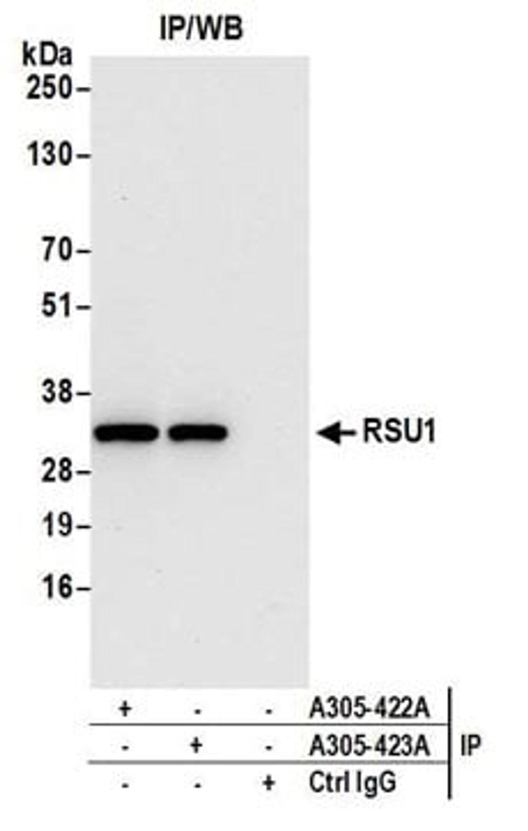 Detection of human RSU1 by western blot of immunoprecipitates.