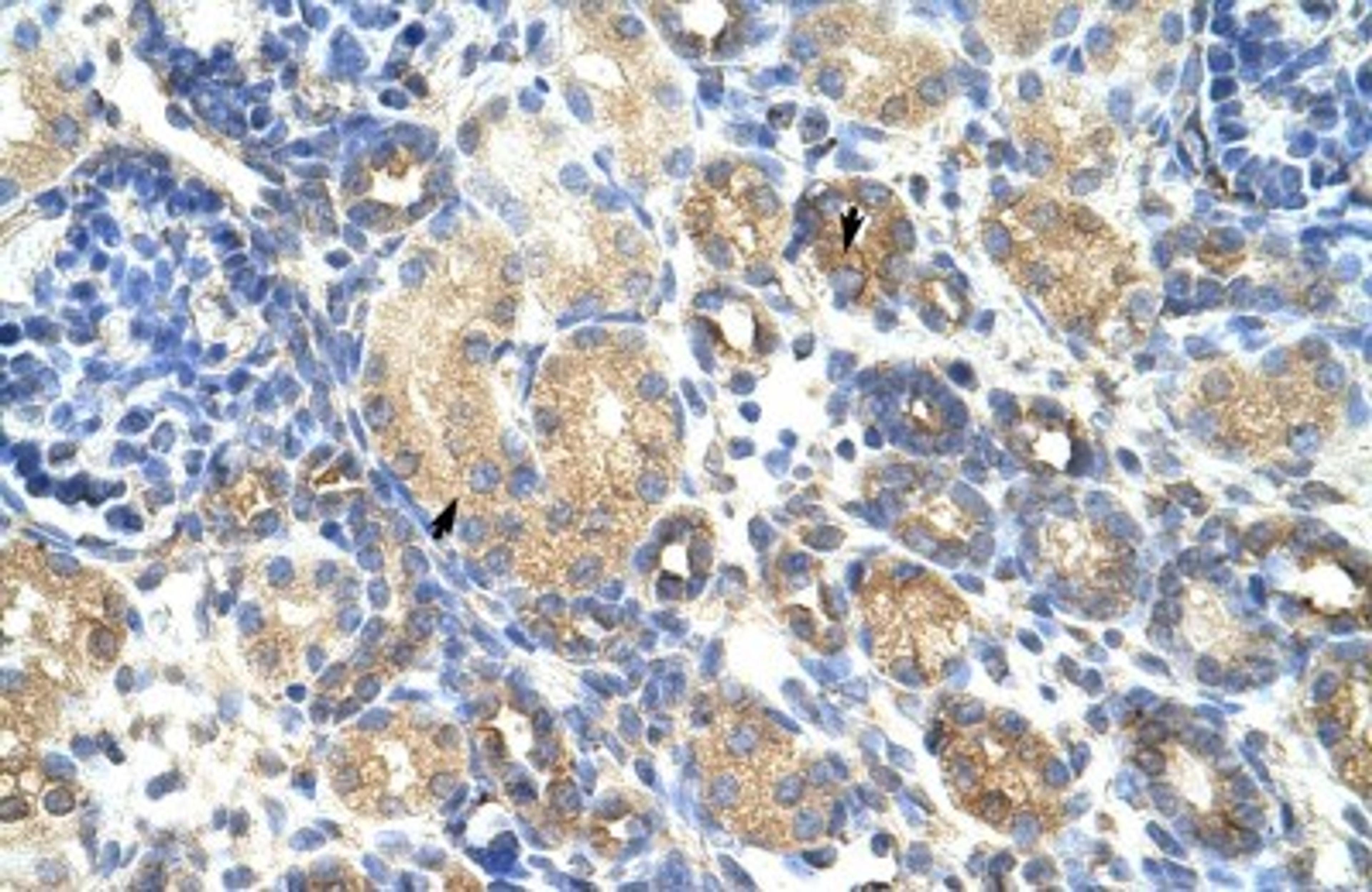 Immunohistochemistry-Paraffin: GNB1L Antibody [NBP1-58342] - Human kidney Tissue, antibody concentration 4-8ug/ml. Cells with positive label: renal corpuscle cells (indicated with arrows) 400X magnification.