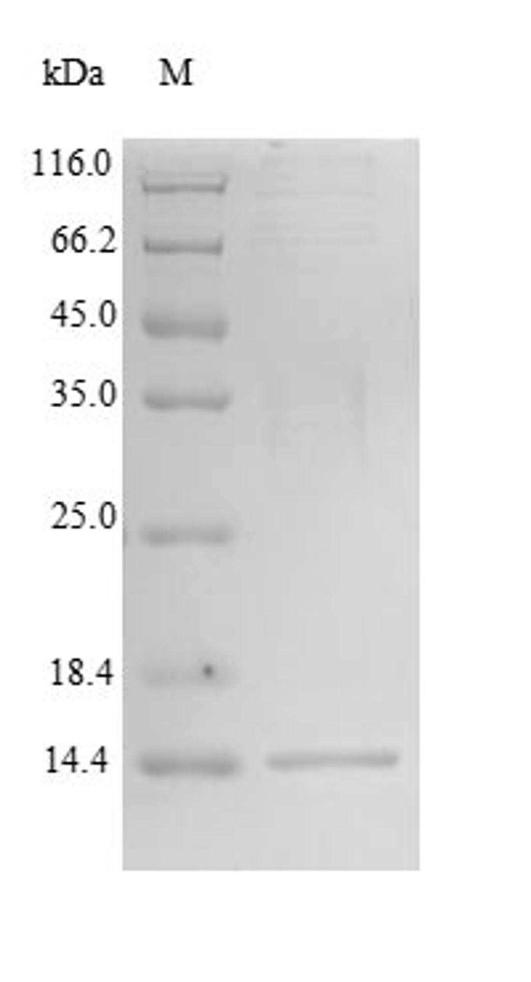 (Tris-Glycine gel) Discontinuous SDS-PAGE (reduced) with 5% enrichment gel and 15% separation gel.