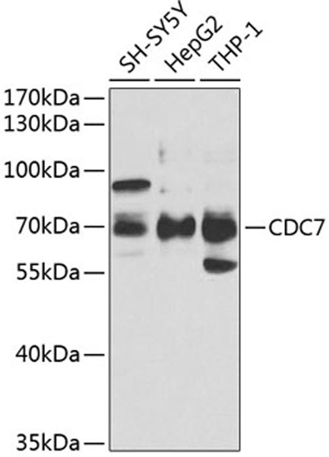 Western blot - CDC7 antibody (A5738)