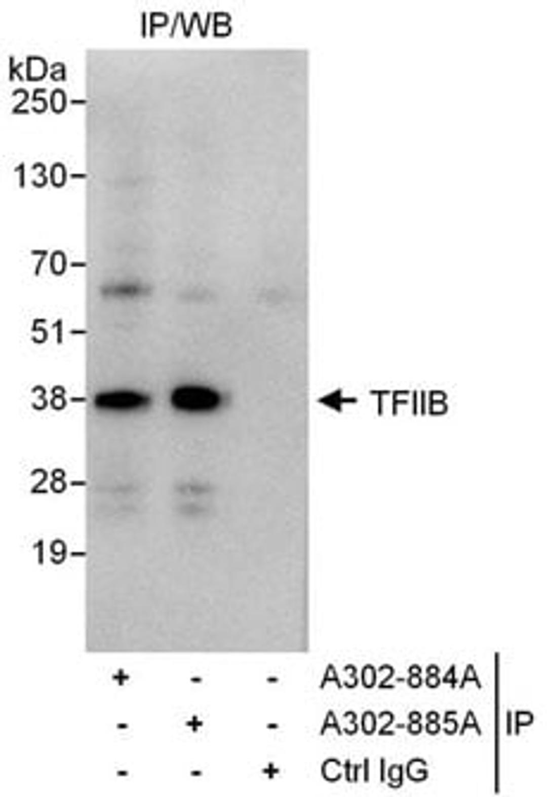 Detection of human GTF2B/ TFIIB by western blot of immunoprecipitates.