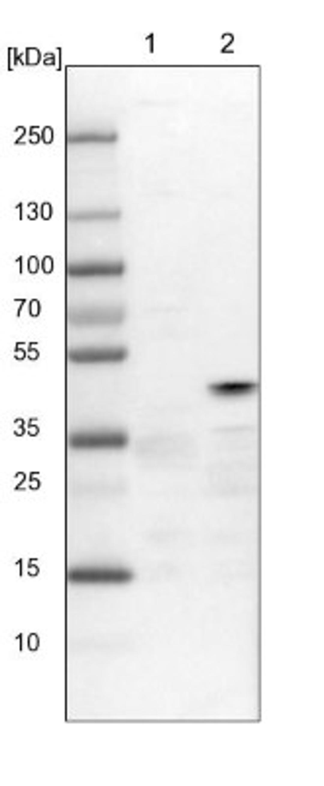 Western Blot: Tuftelin 1 Antibody [NBP1-87446] - Lane 1: NIH-3T3 cell lysate (Mouse embryonic fibroblast cells)<br/>Lane 2: NBT-II cell lysate (Rat Wistar bladder tumour cells)