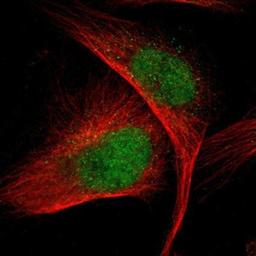 Immunocytochemistry/Immunofluorescence: VRK1 Antibody [NBP1-85822] - Staining of human cell line U-251MG shows positivity in nucleus but not nucleoli.