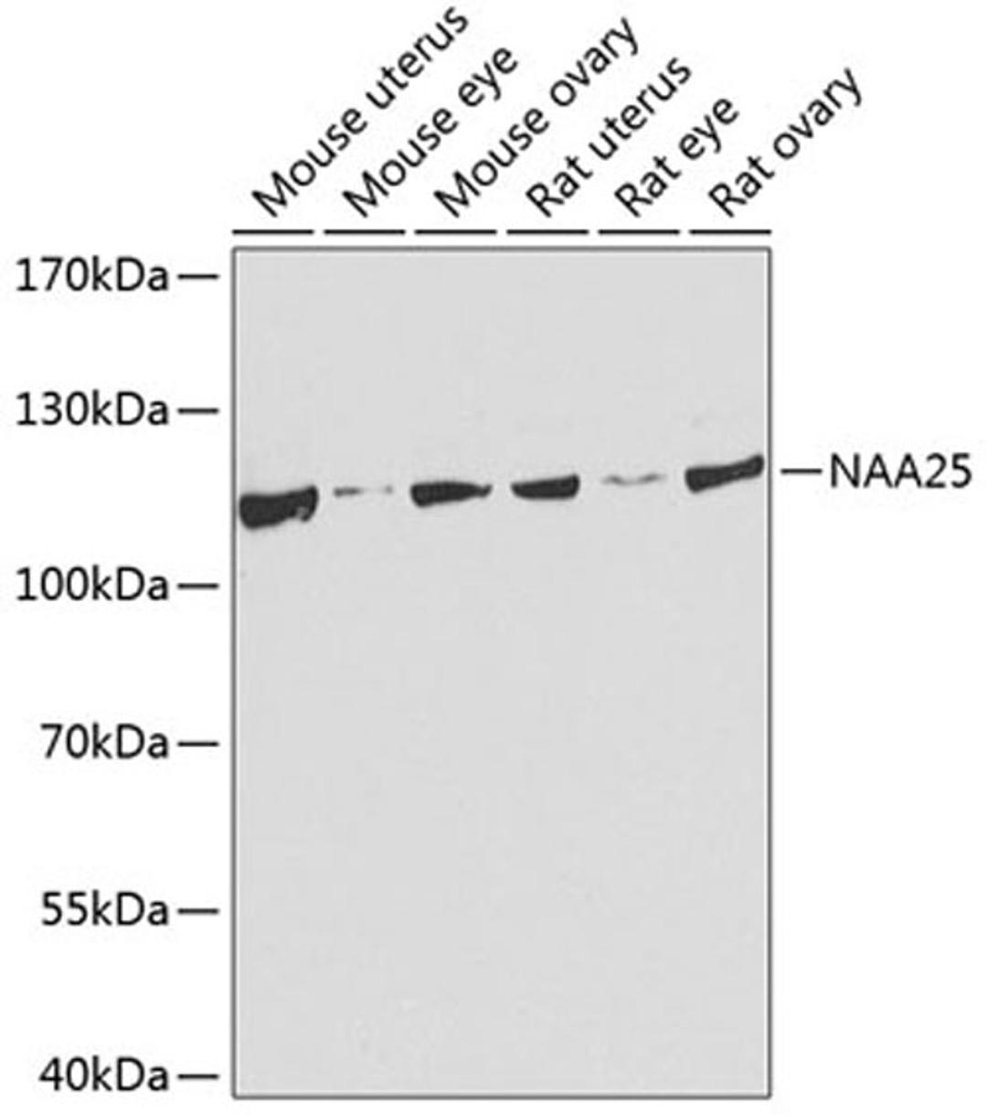 Western blot - NAA25 antibody (A8516)