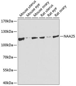 Western blot - NAA25 antibody (A8516)