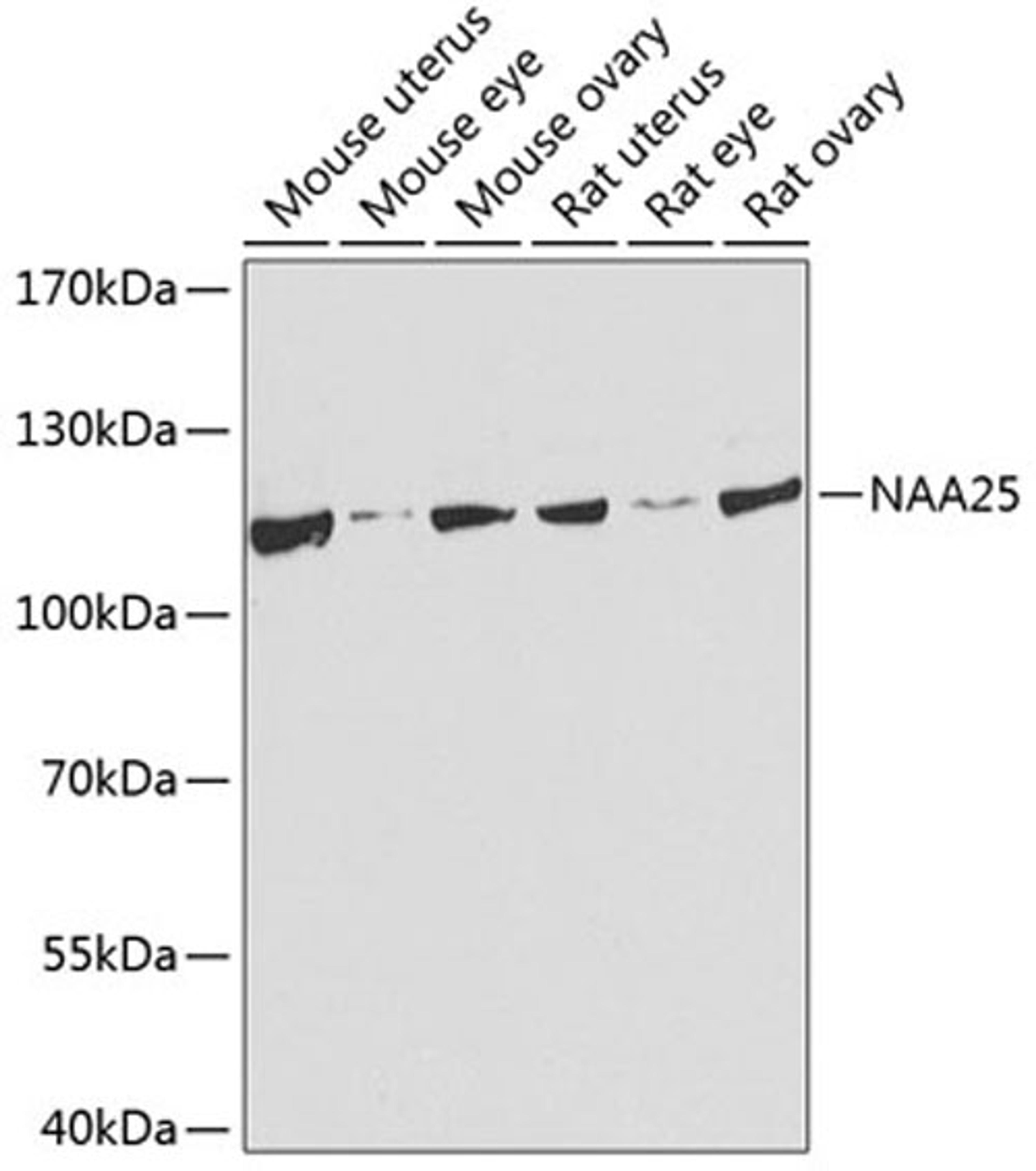 Western blot - NAA25 antibody (A8516)