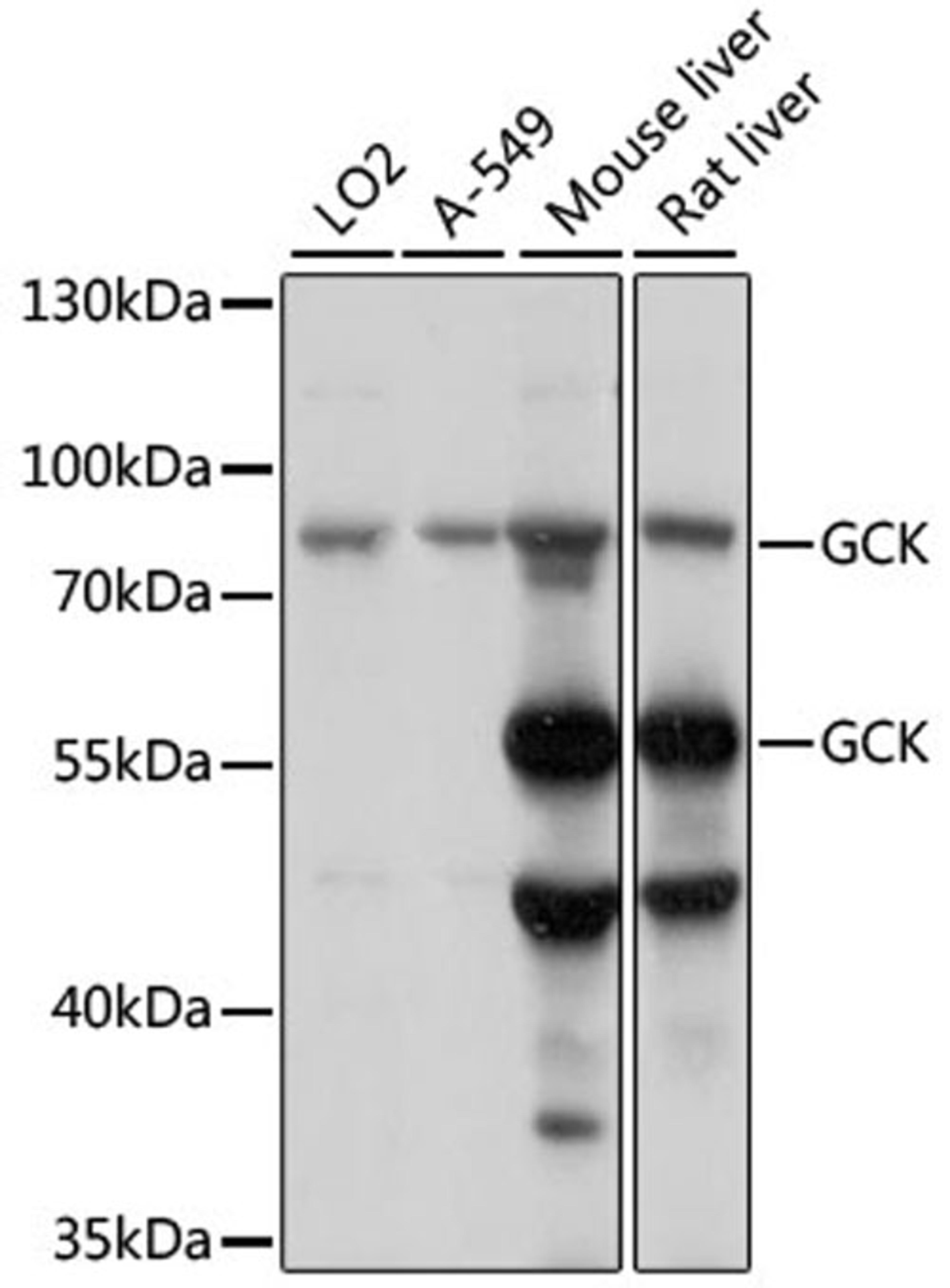 Western blot - GCK antibody (A15059)