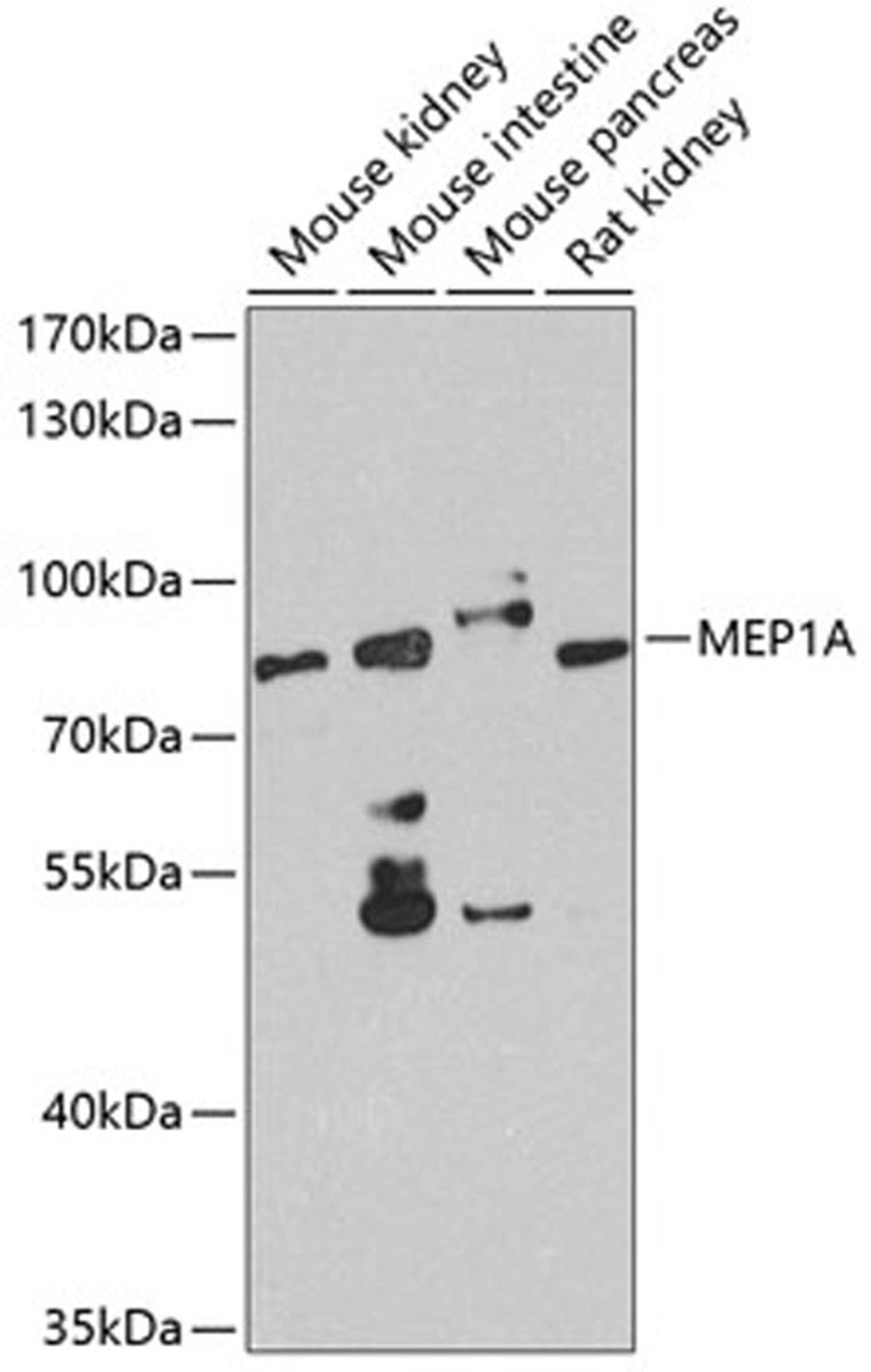 Western blot - MEP1A antibody (A8133)